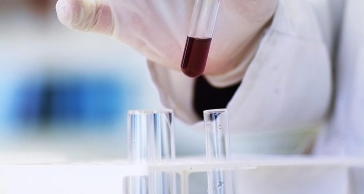 découvrez les transferts historiques qui ont marqué l'histoire du sport et changé le paysage des compétitions.